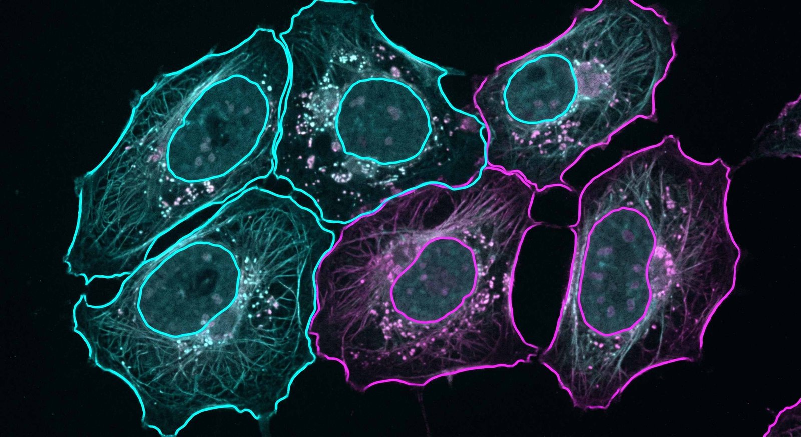 Cell Segmentation with Deep Learning